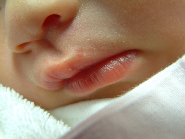 唇の乾燥対策で赤ちゃんはどうする 切れてしまった時は 双子ままの日々のコト